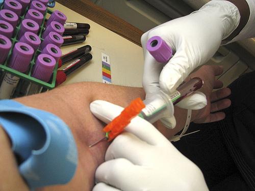 o que é o exame de glicemia e para que serve? \u2022 laboratório cavalieriexame de glicemia análise que confirma a diabetes créditos lori greig fonte